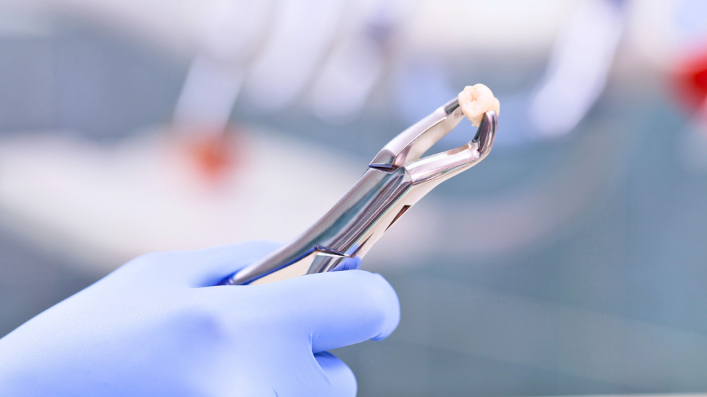 Cirurgia Oral